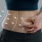 liposculpting surgery - body contouring