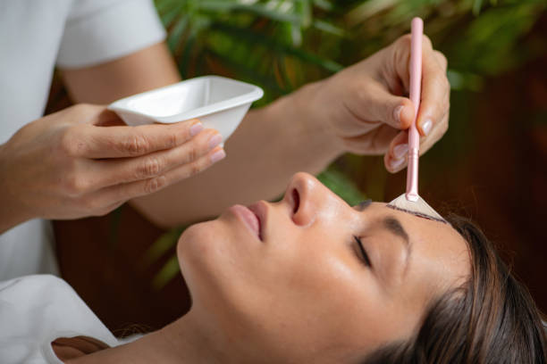 chemical peeling treatment