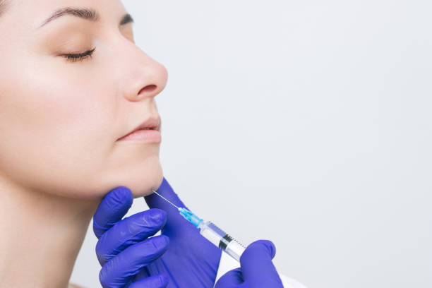 chin augmentation implant