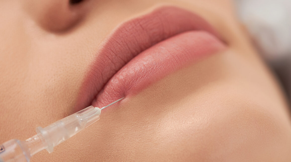 Lip Fillers in Bangalore