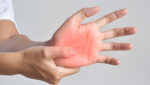 Expert Hand & Peripheral Nerve Injury Treatment in Bangalore