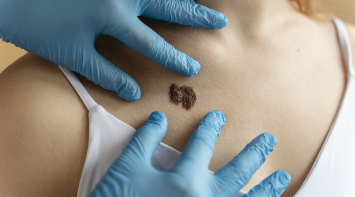 Reconstructive Surgery in Bengaluru